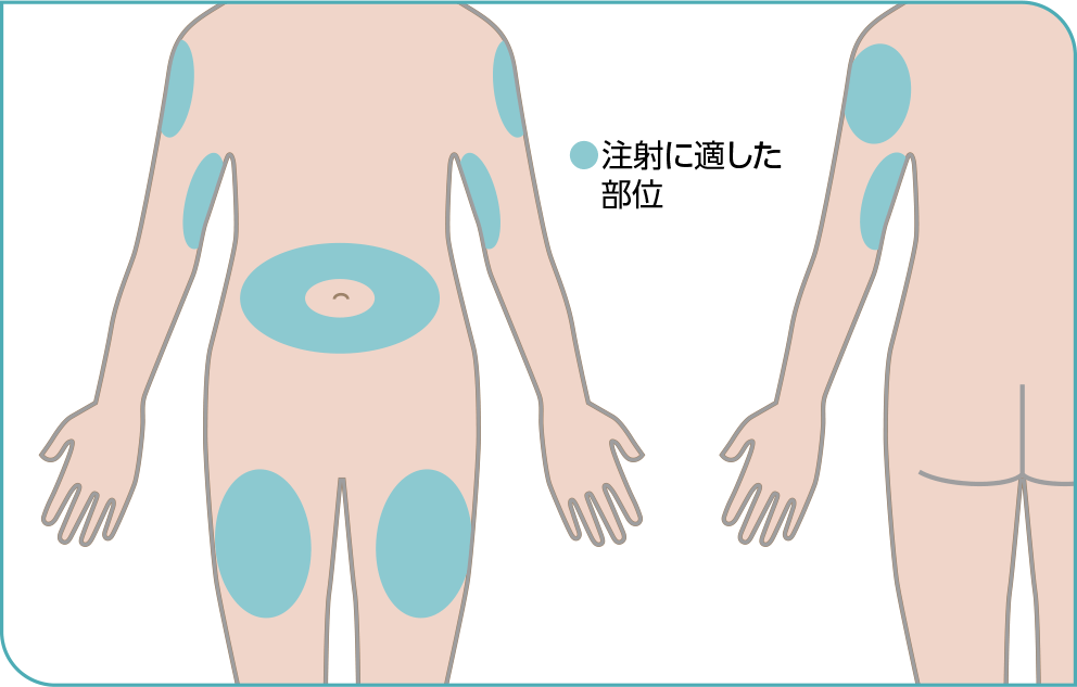 注射に適した部位